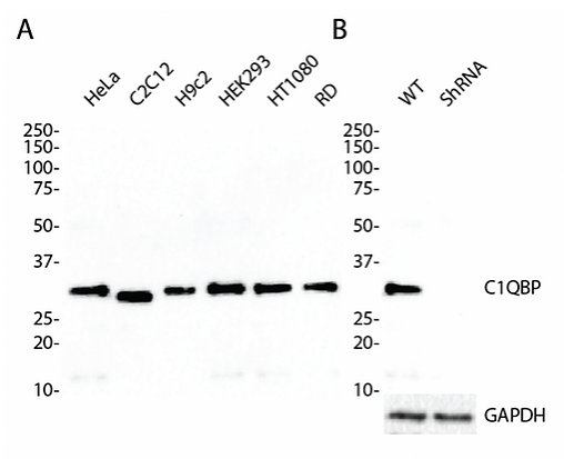 （1166）Complement C1q Binding Protein rabbit mAb